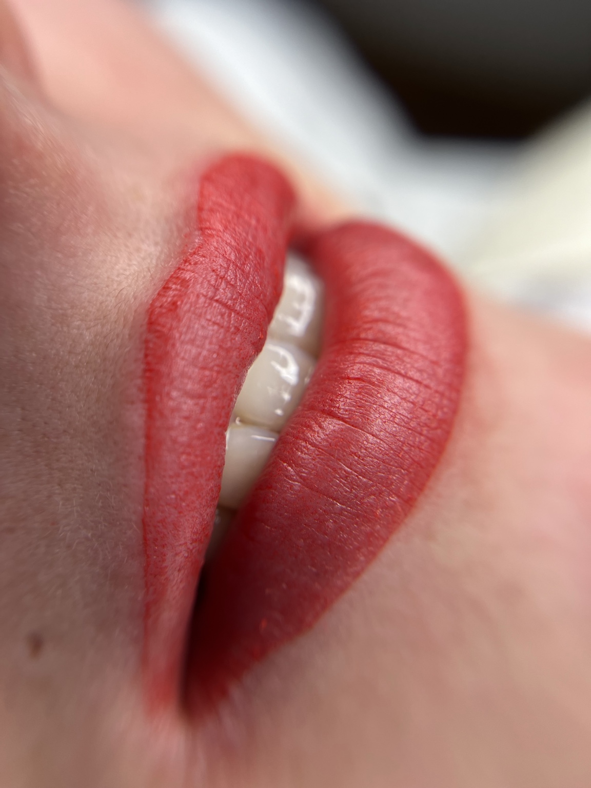 Estética